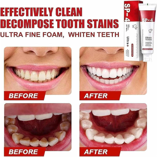 Toothpaste Probiotic Stain Remover Stain Removing Toothpaste, Protects Gums Freshens Breath, for Everyone